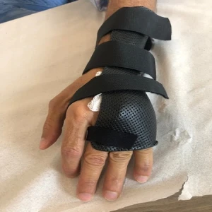 Consultório de Terapia da Mão - Terapia Ocupacional