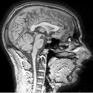 NEUROLAGES